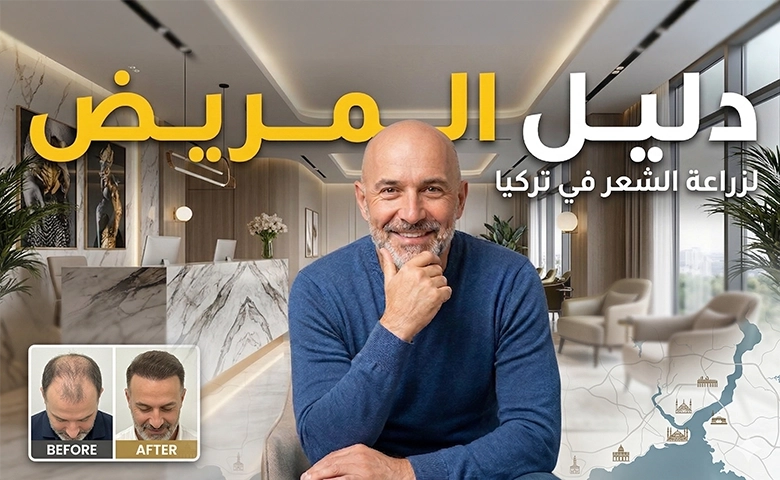 دليل المريض لزراعة الشعر في تركيا