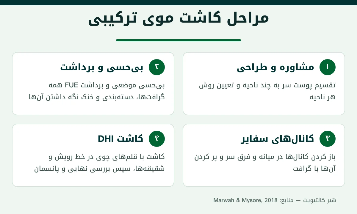 اینفوگرافیک مراحل کاشت موی ترکیبی از طراحی نواحی تا کانالهای سفایر و کاشت DHI