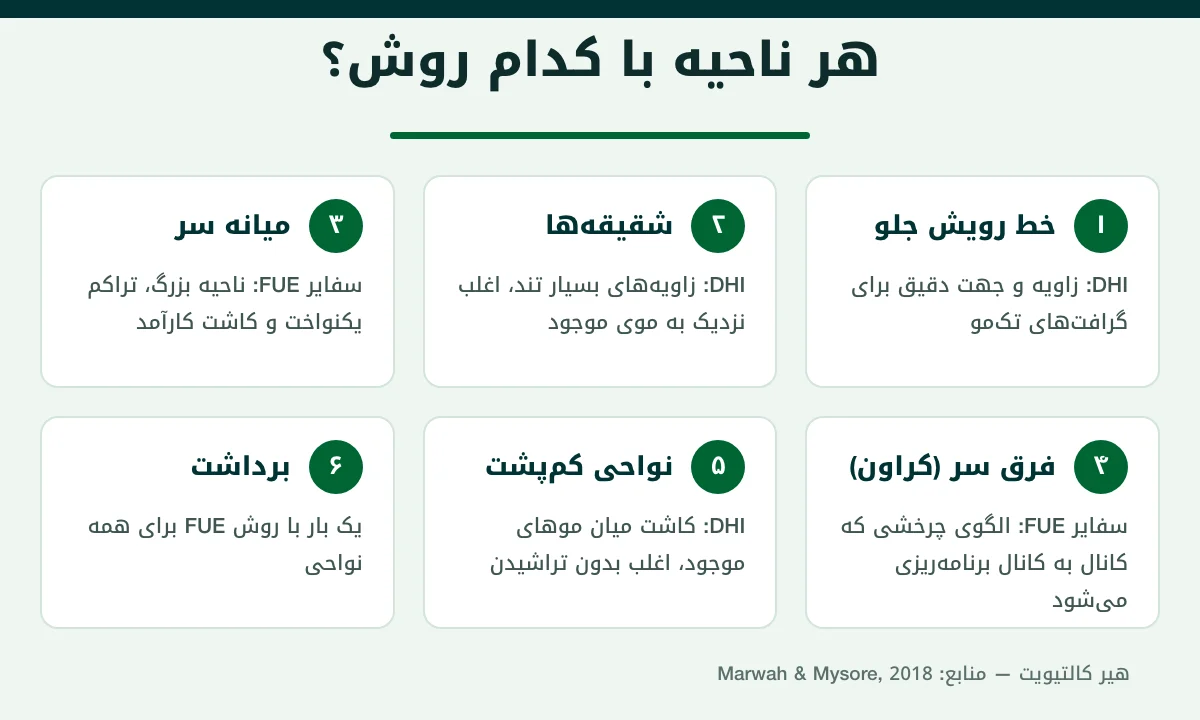 اینفوگرافیک کاشت موی ترکیبی: روش مناسب برای خط رویش، شقیقه، میانه و فرق سر