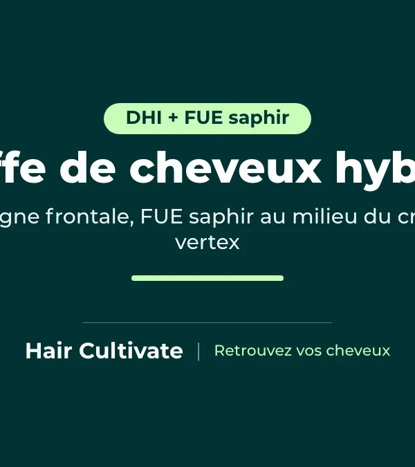 Greffe de cheveux hybride à Istanbul associant DHI et FUE saphir