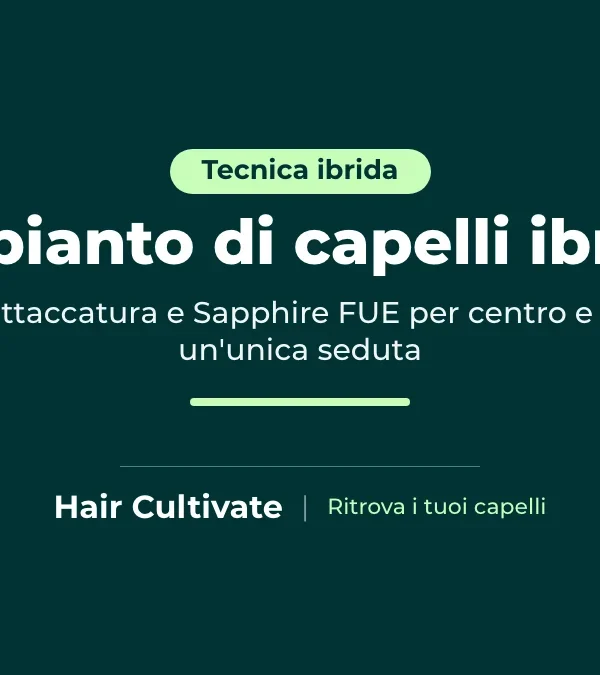 Trapianto di capelli ibrido con DHI sull'attaccatura e Sapphire FUE su centro e vertice
