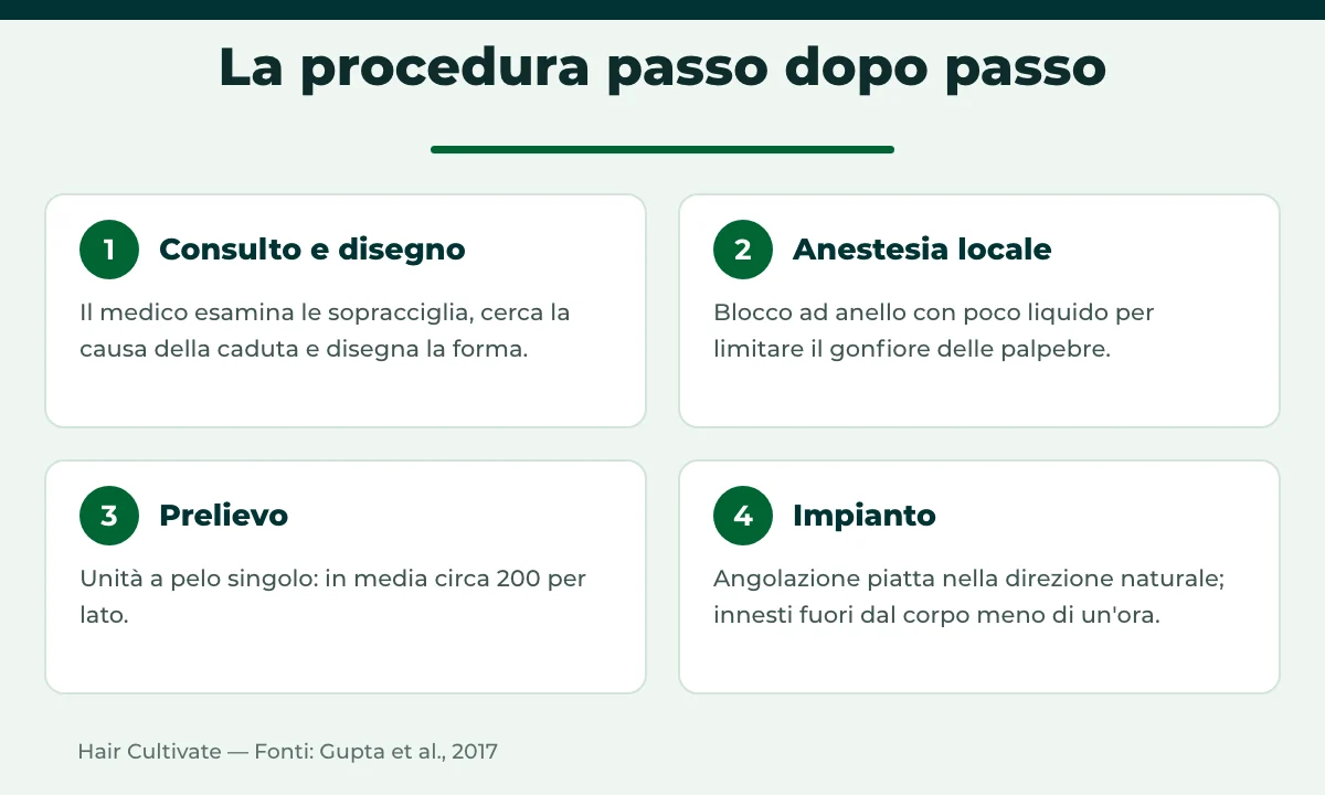 Fasi del trapianto di sopracciglia in Turchia: consulto, anestesia, prelievo e impianto