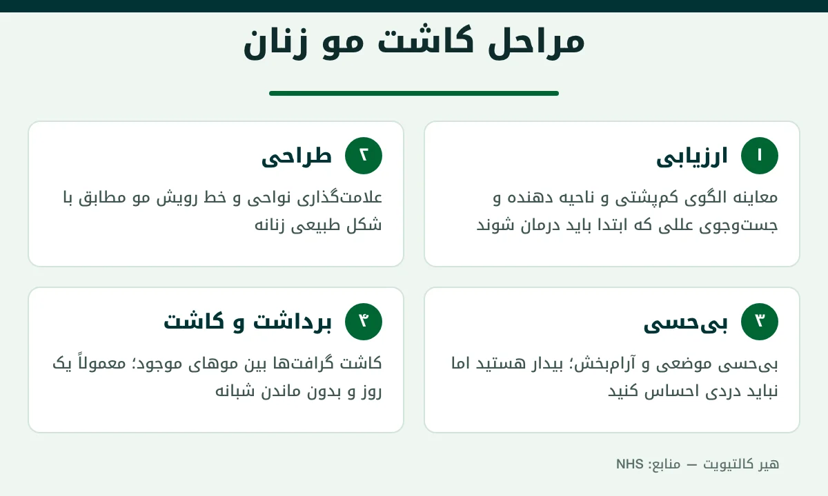 اینفوگرافیک مراحل کاشت مو زنان در ترکیه: ارزیابی، طراحی، بی‌حسی، برداشت و کاشت