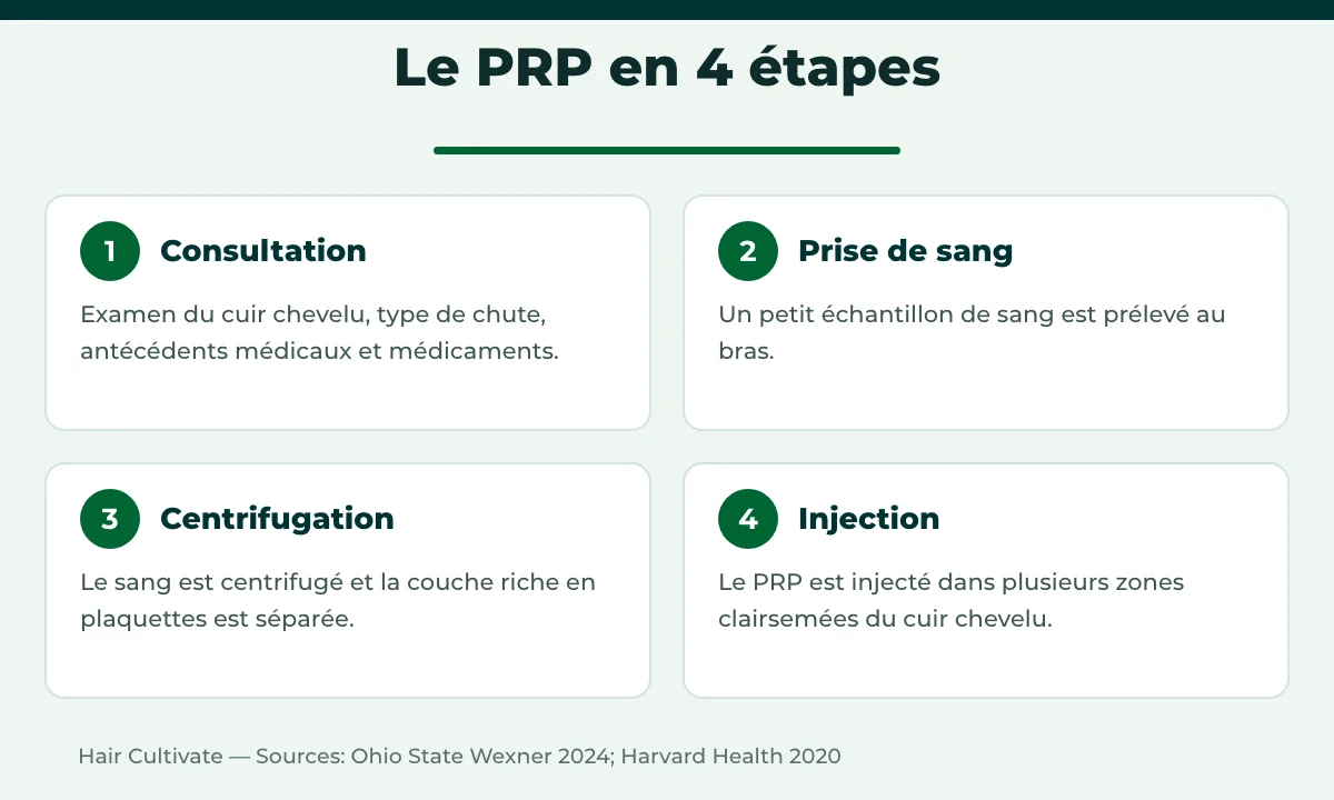 Étapes du PRP cheveux en Turquie : consultation, prise de sang, centrifugation, injection
