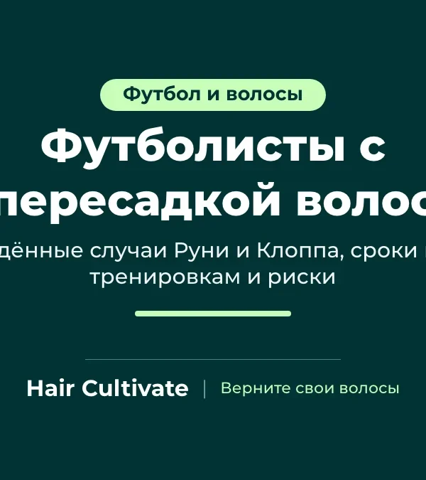 Футболисты с пересадкой волос: подтверждённые случаи Уэйна Руни и Юргена Клоппа