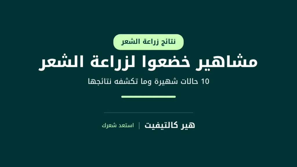 مشاهير خضعوا لزراعة الشعر