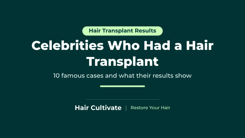 Celebrities Who Had a Hair Transplant