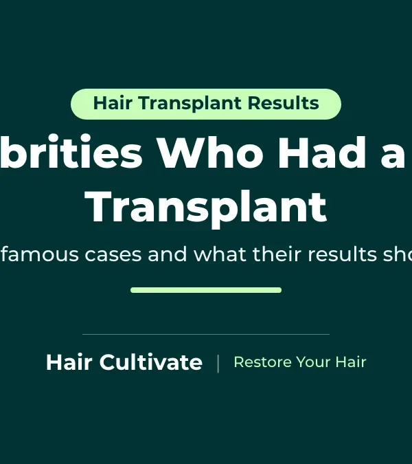 Celebrities Who Had a Hair Transplant
