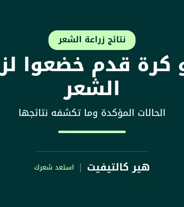 لاعبو كرة قدم خضعوا لزراعة الشعر