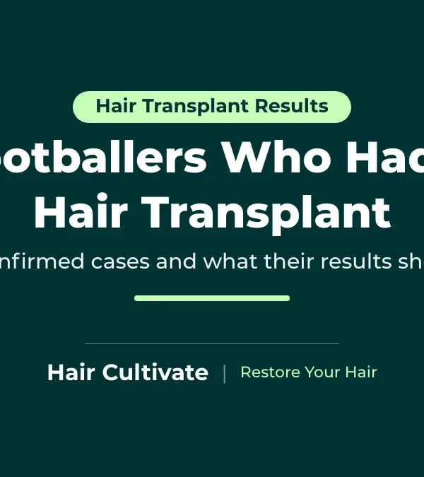 Footballers Who Had a Hair Transplant