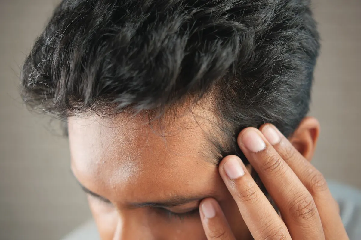 Man gently touching his hair during the recovery period after a hair transplant