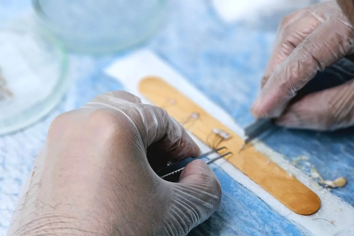 Gloved hands preparing hair grafts on a tray for a DHI hair transplant with the Choi pen