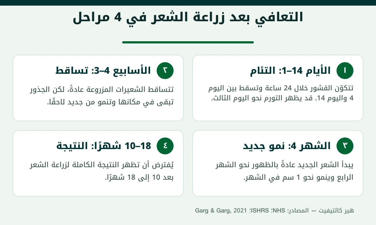 التعافي بعد زراعة الشعر في أربع مراحل من اليوم الأول حتى الشهر 18