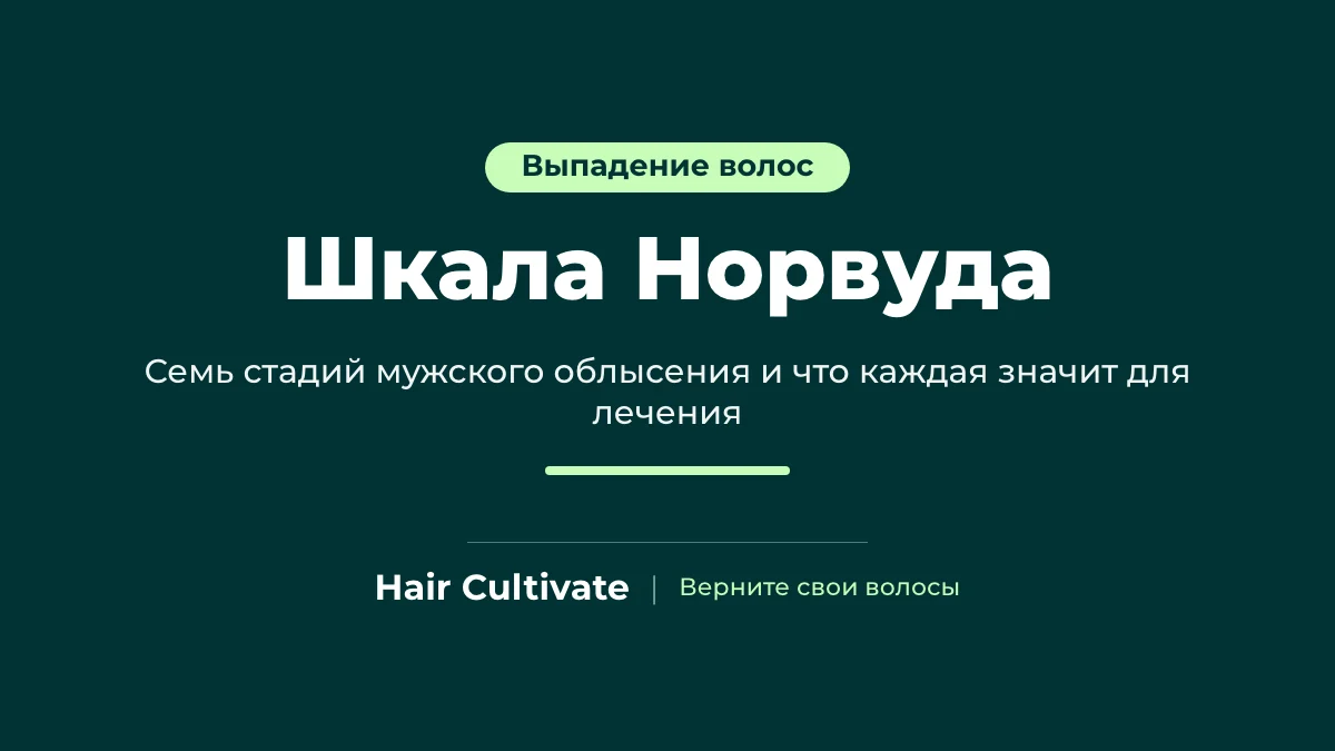 Шкала Норвуда: стадии облысения по мужскому типу