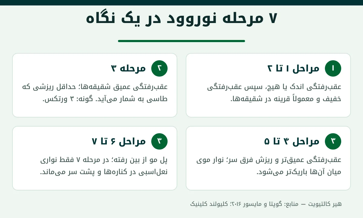 ۷ مرحله مقیاس نوروود برای ریزش موی الگوی مردانه